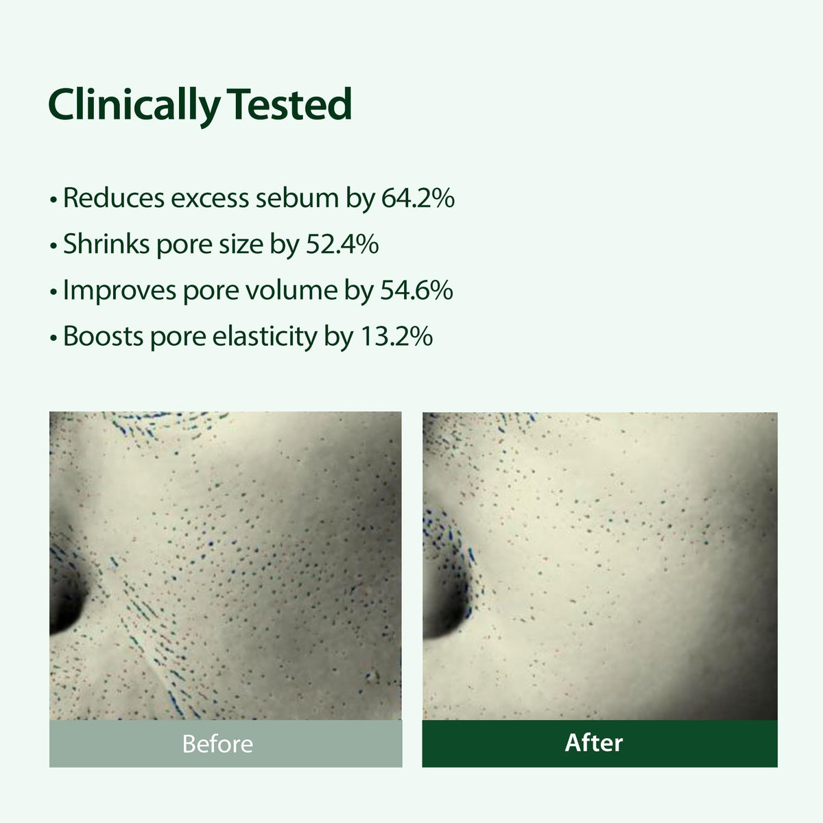 BLITHE Targeted Pore Serum with 22% Niacinamide for Oil Control, Pore Minimizer for Face, Korean Skin Care,1 fl oz