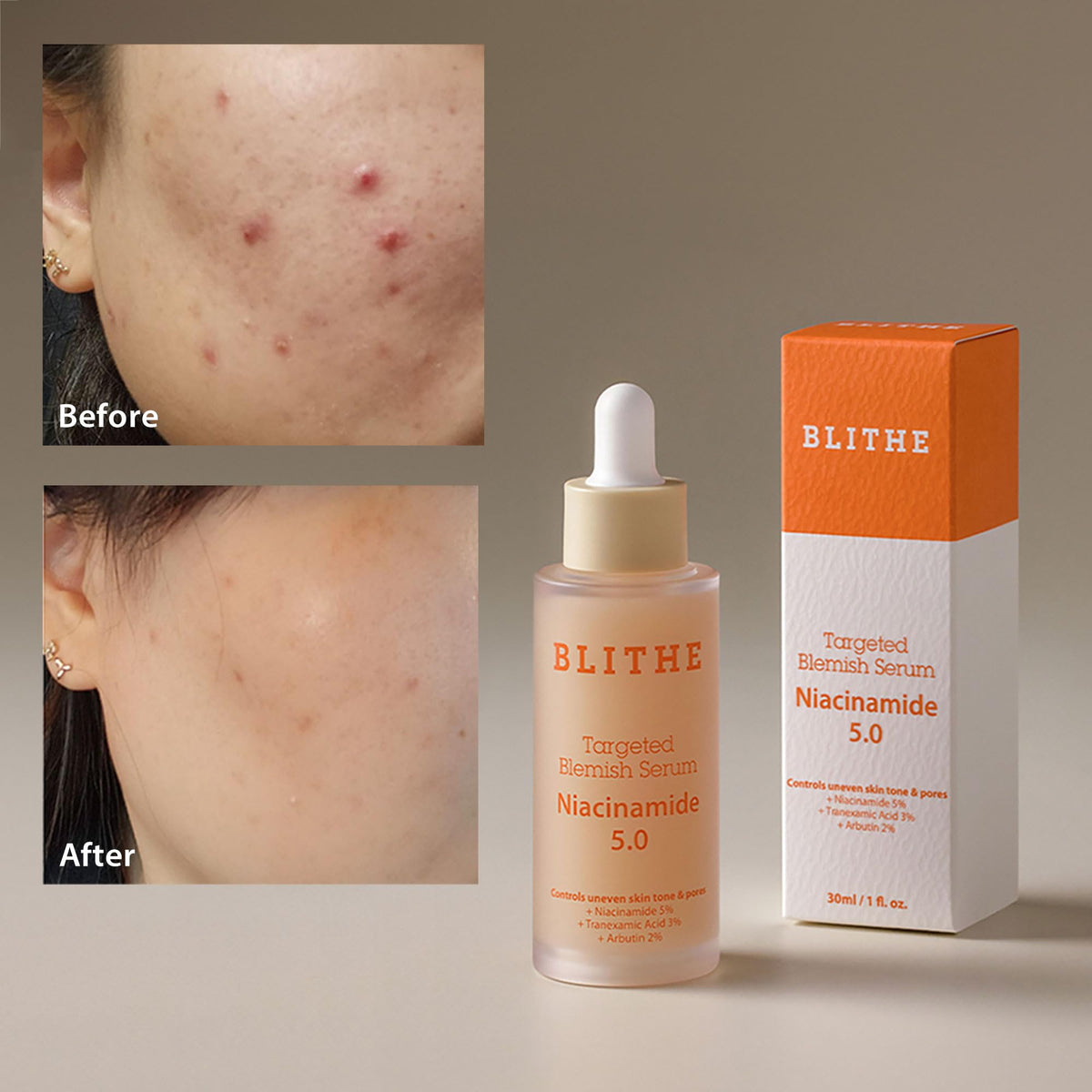 BLITHE Dark Spot Corrector & Tightening Serum Bundle Set, Niacinamide 5% and Pressed Serum Tundra Chaga, Best Korean Skincare